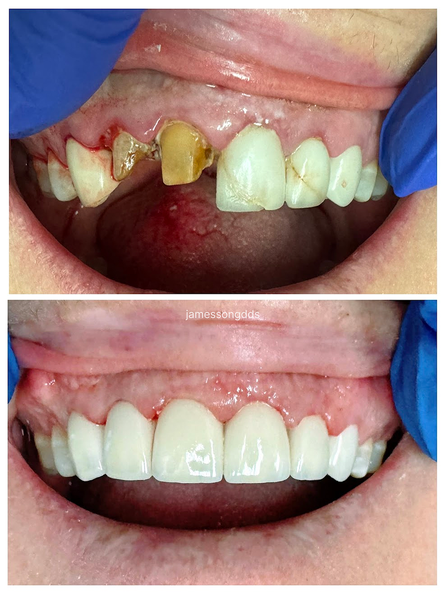 Case 10