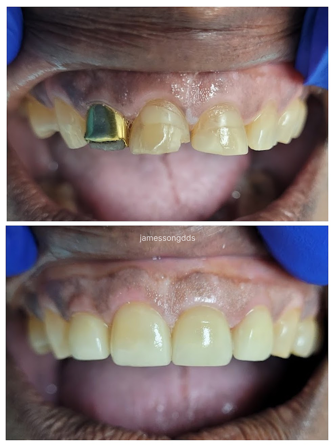 Case 2