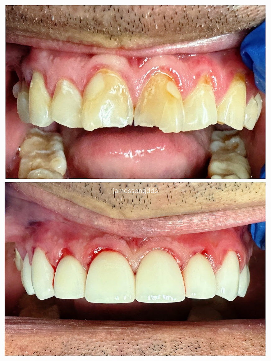 Case 5